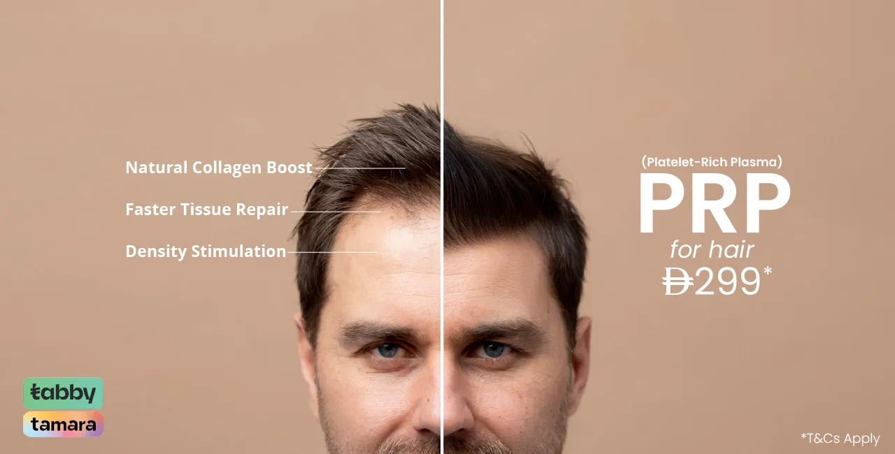 PRP Treatment For Hair