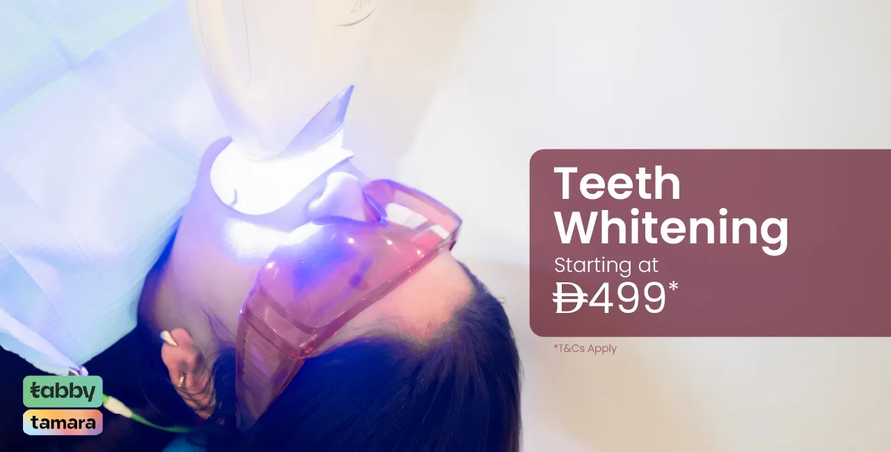Teeth Whitening at UAE