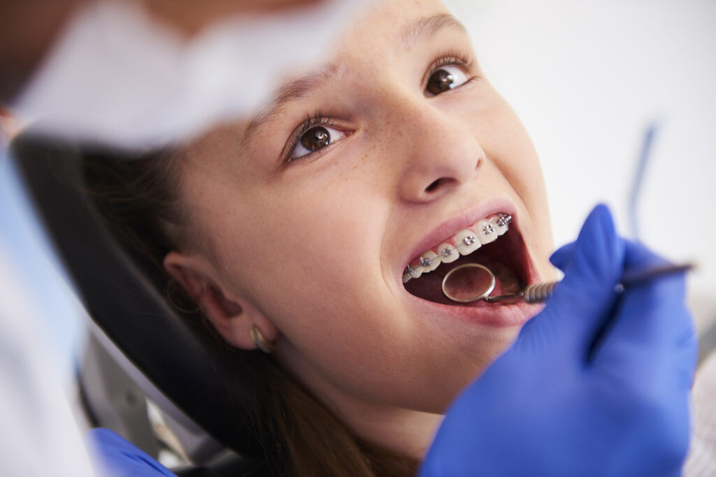 Braces dental examination