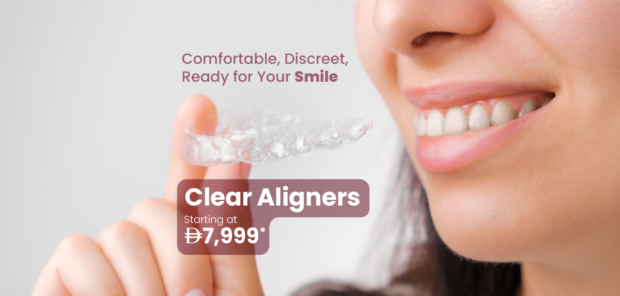 Clear Aligners